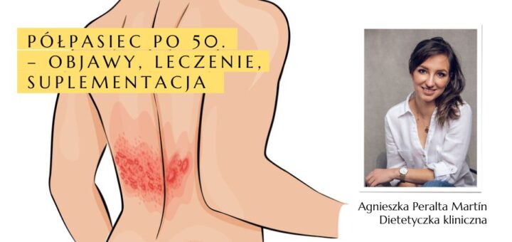 Rysunek postaci z pęcherzami półpaśca na plecach